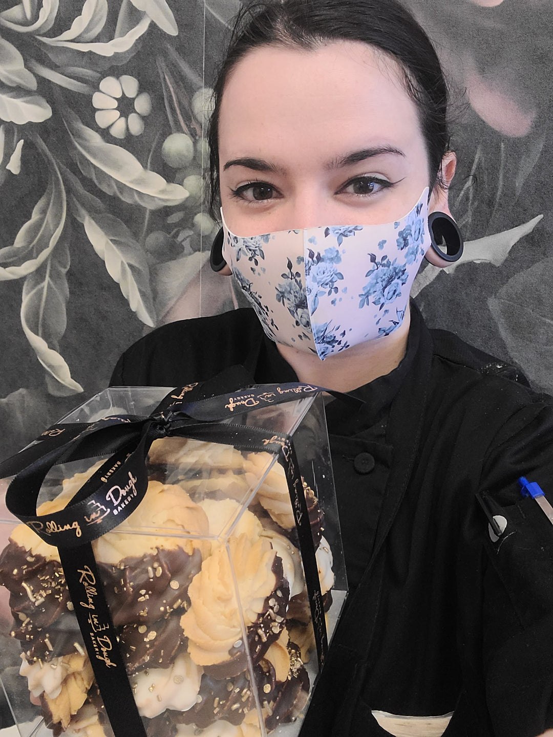 Ouch! Injuries and Accidents of Working in a Bakery